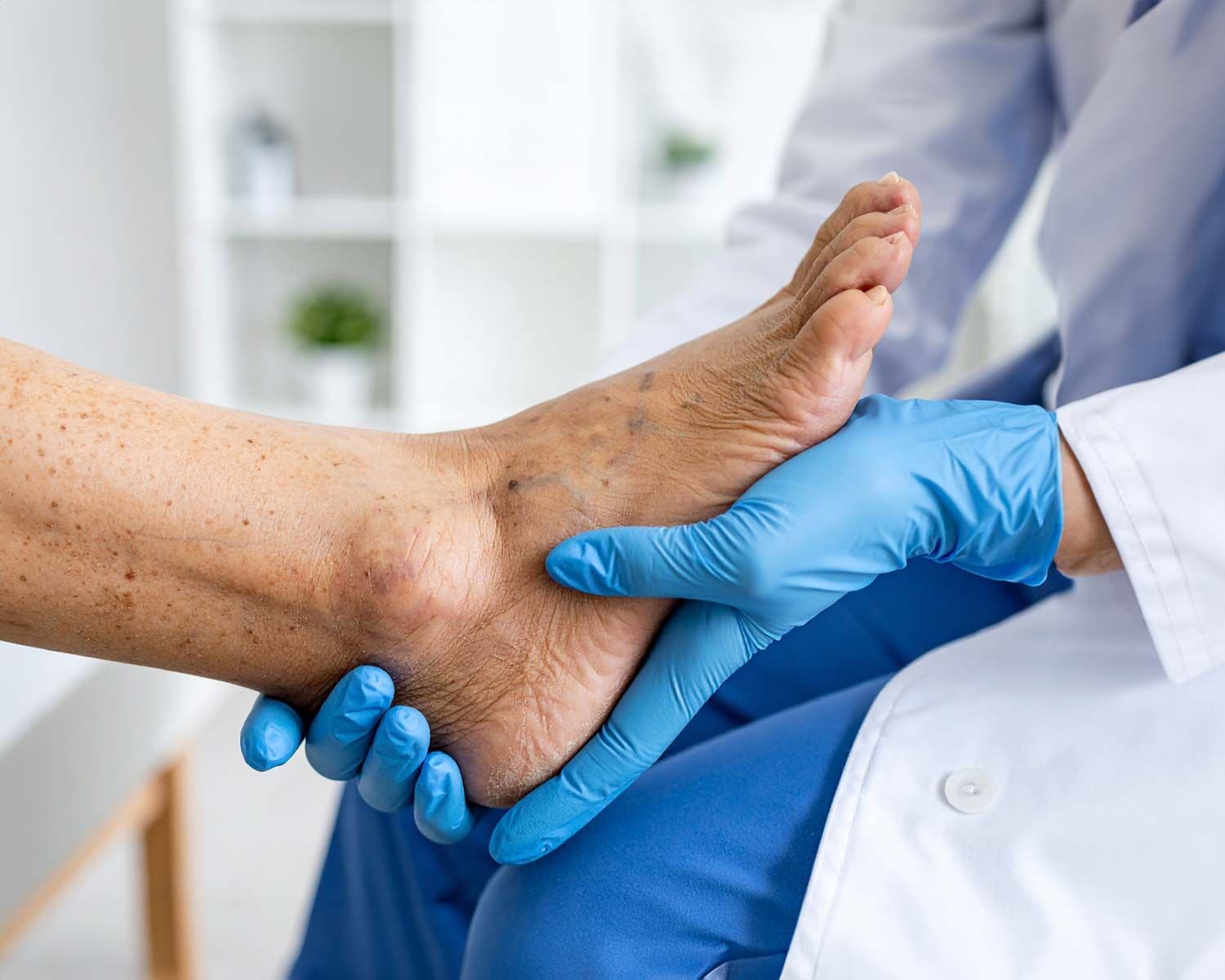 Arzt hält Fuß und Knöchel eines älteren Patienten mit sichtbaren Venen